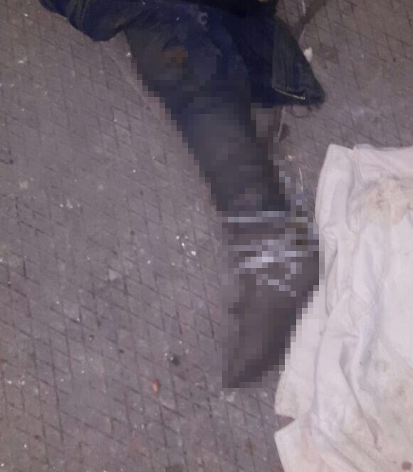 Çöpten çıkan bacağı bakın ne yapacaklar!