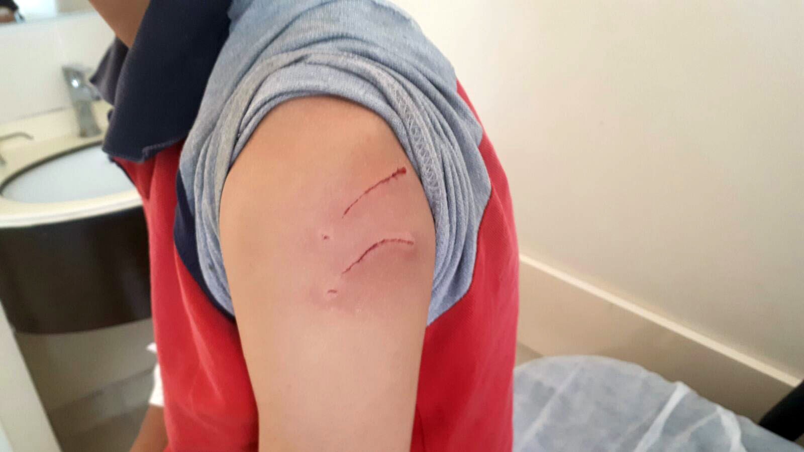 Adıyaman'da vaşak saldırısına uğrayan 2 kişi yaralandı