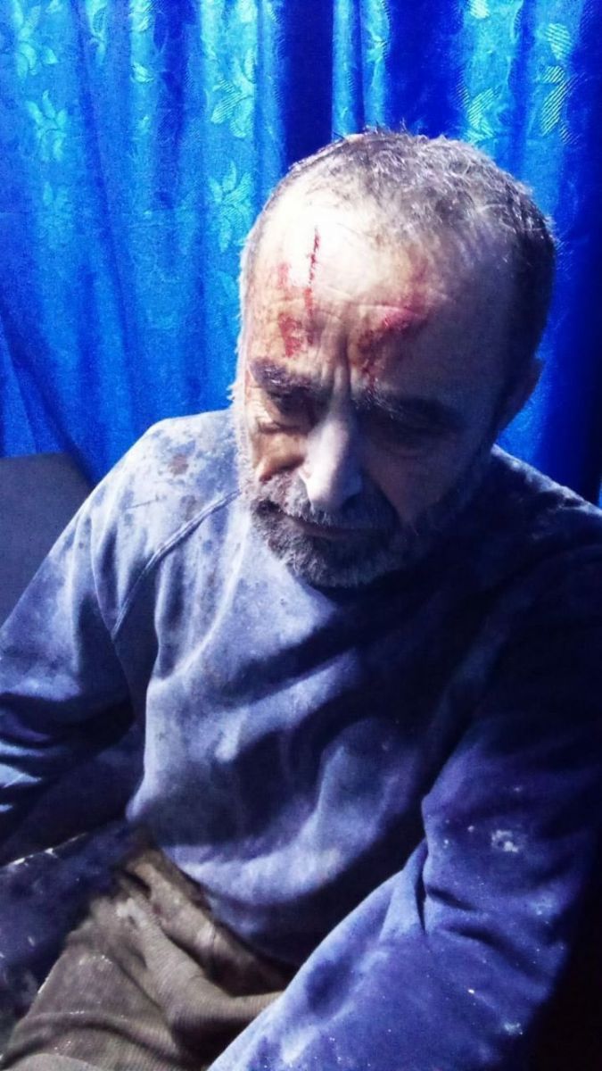 PKK Afrin’de sivilleri vurdu