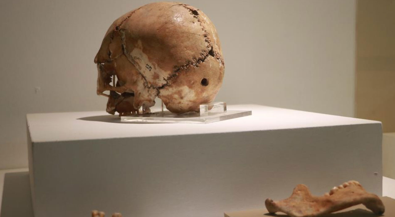 10 bin 500 yıl önce dünyanın ilk beyin ameliyatı Aksaray'da yapıldı