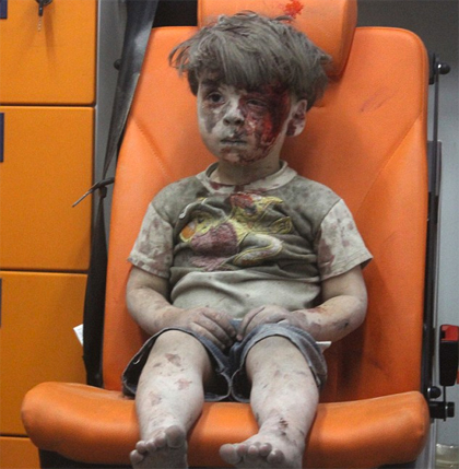 Suriye savaşının sembolü olan Umran ailesine kavuştu