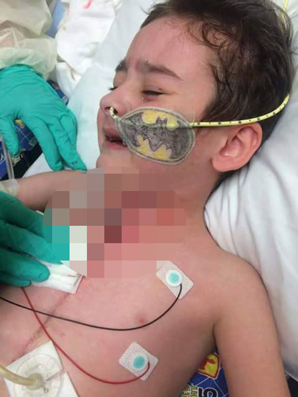 Henüz 7 yaşında 61 kere de ameliyat oldu, yardımlarınızı bekliyor