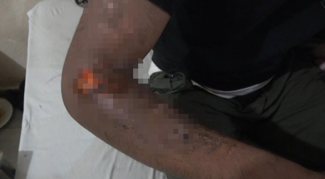 Yunan askerlerinin işkence ettiği Pakistanlı göçmenler Türk askerlerinin yardımıyla kurtuldu