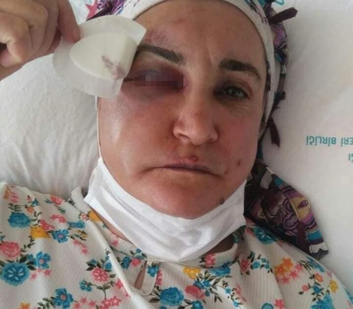 Sokak ortasında kadınlara saldıran şahıs tutuklandı