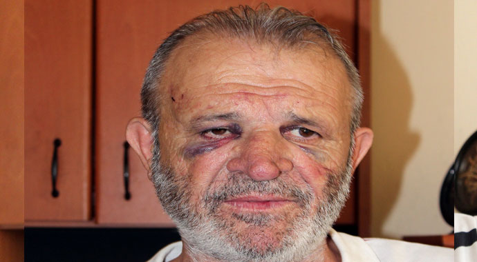 Yalova’da avukata meydan dayağı