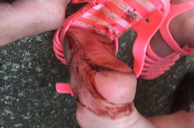 Yarım saatte ayağı bu hale geldi