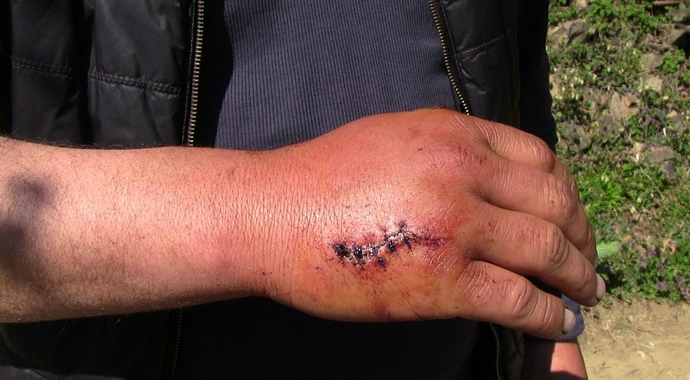 Ayı saldırıları köylüleri canından bezdirdi