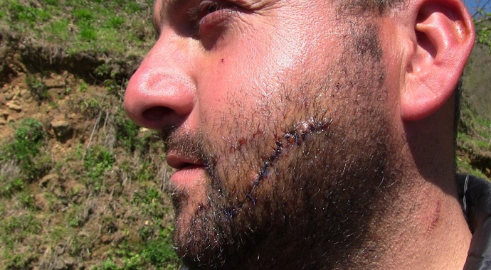 Ayı saldırıları köylüleri canından bezdirdi