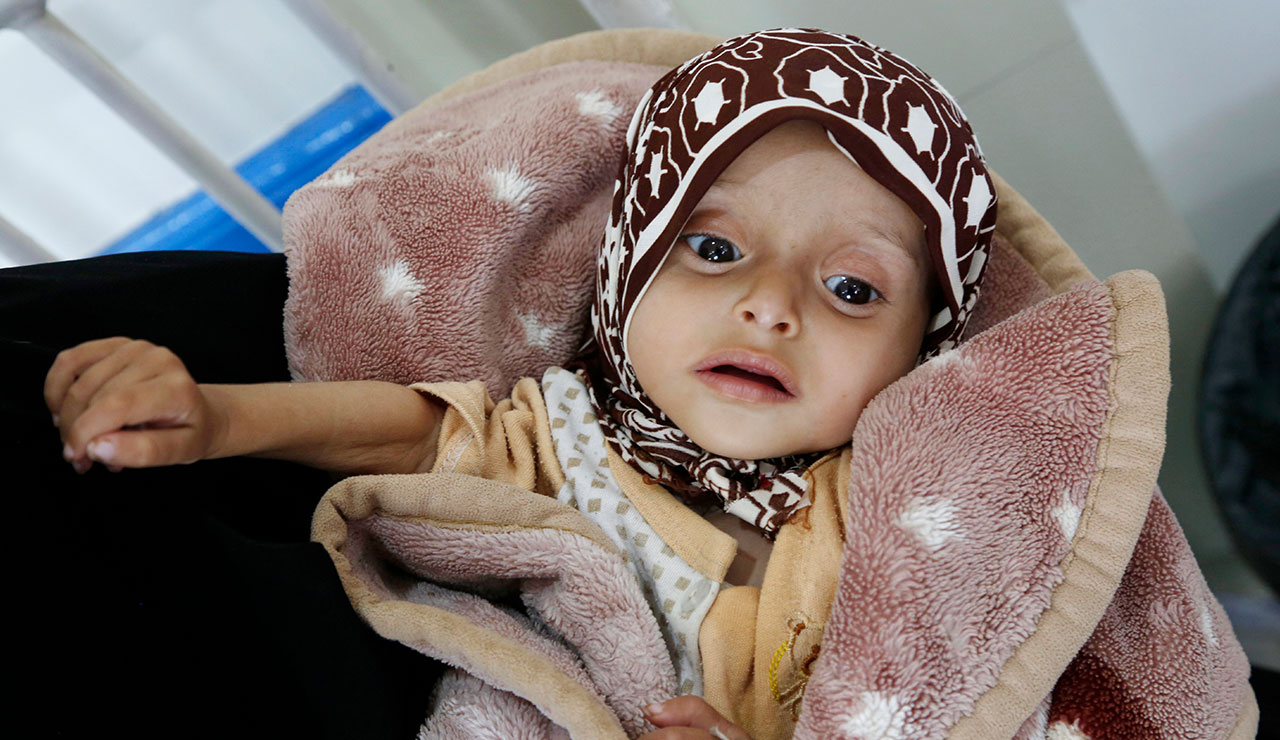 Dünyada her 10 kişiden biri aç yatıyor