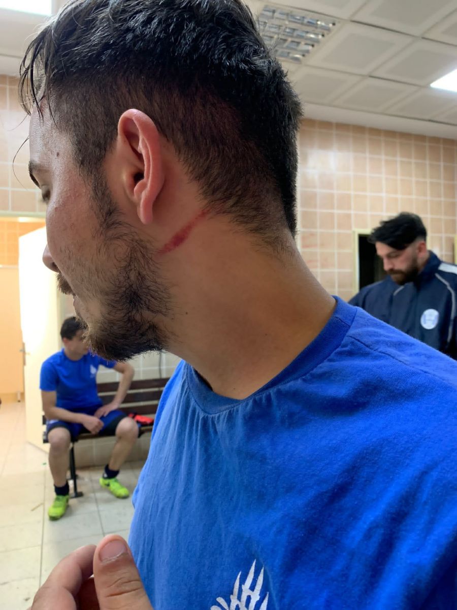 Maçta saha boks ringine döndü! 4 futbolcu tekme tokat dayak yedi