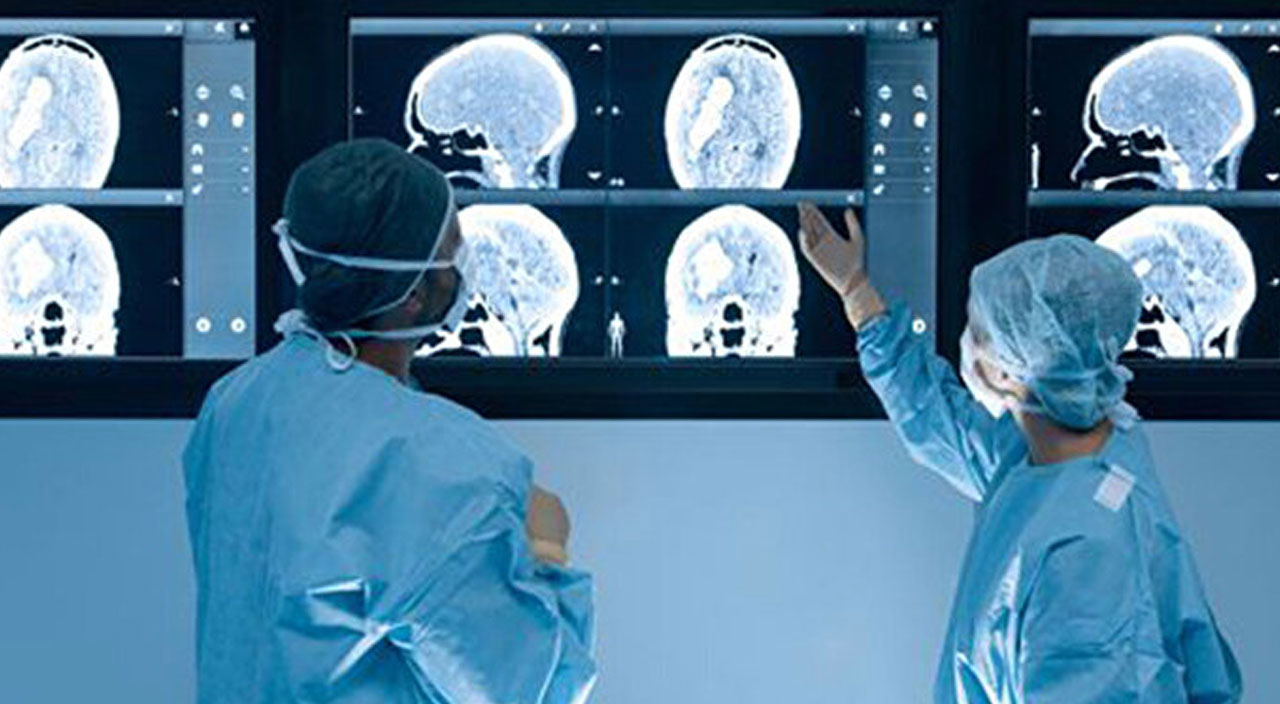 İnsan beyni küçülüyor! Nedeni ise obezite