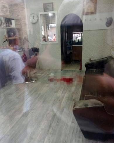 Berberde dehşet! Saçını kestirirken ayağından olacaktı