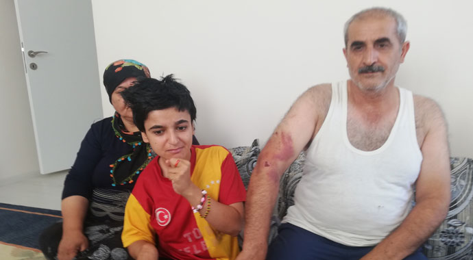 Engelli kız ve babasına ‘Bana niye oy vermedin’ dayağı