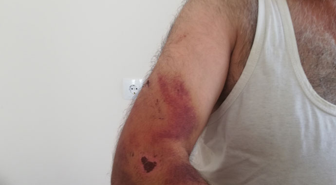 Engelli kız ve babasına ‘Bana niye oy vermedin’ dayağı