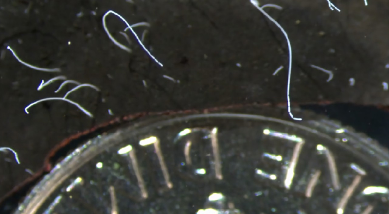 Bilim dünyasında tartışmaya yol açtı: Fıstık büyüklüğünde bakteri keşfedildi