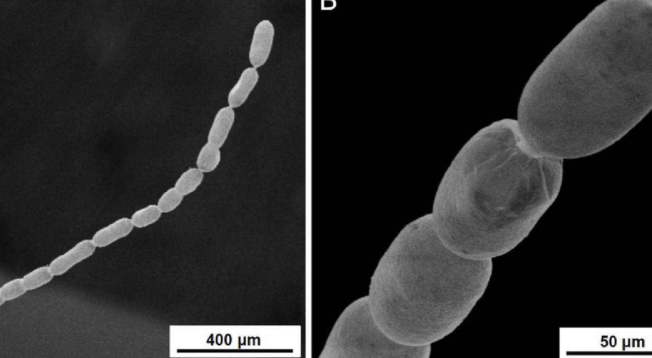 Bilim dünyasında tartışmaya yol açtı: Fıstık büyüklüğünde bakteri keşfedildi