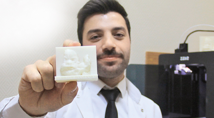 Görme engelli çift bebeklerine doğmadan dokundu