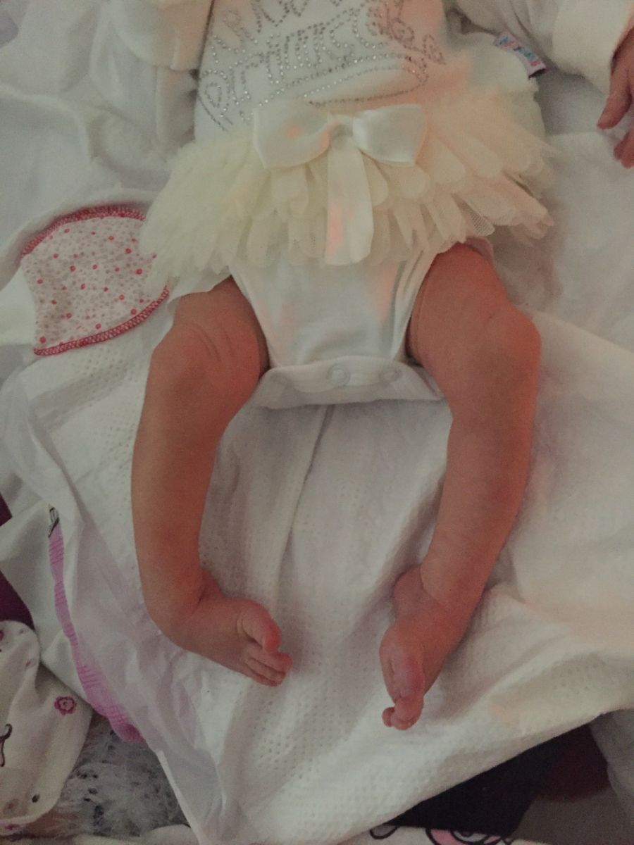 ‘Doktorun ihmali bebeği ayağından ediyordu’ iddiası