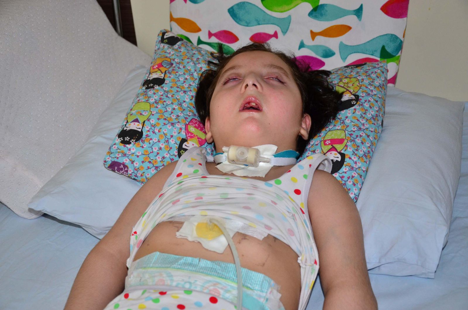 Bir kabak çekirdeğiyle yatağa mahkum oldu