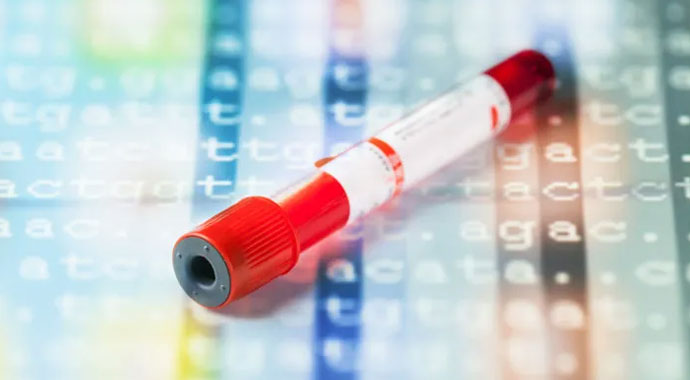 Bilirubin nedir? Yüksek Bilirubin ve Düşük Bilirubin seviyesi ne anlama gelir?