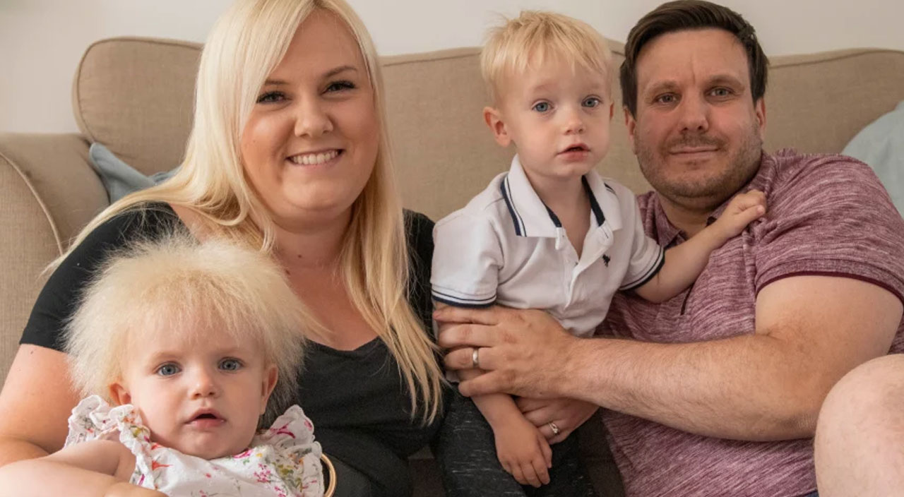 Lakabı Boris! Hastalığı taranamayan saç sendromu: Dünyada sadece 100 kişide var