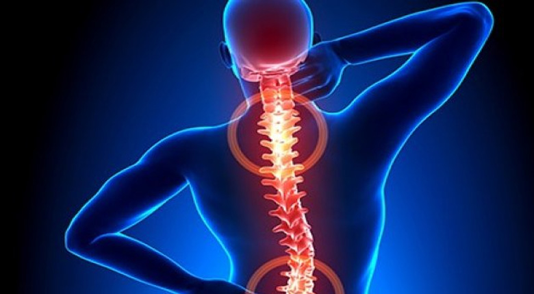 Boyun fıtığı neden olur? (Boyun Fıtığı Tedavi Yöntemleri)