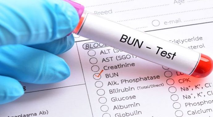 BUN nedir? | BUN değerleri ne olmalı? | BUN normal değerler nasıl olmalıdır? Bun Yüksekliği ve BUN düşüklüğü değerleri