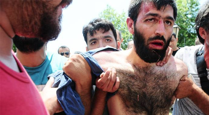 Camiyi karıştıran sahte 'canlı bomba' bakın kim çıktı?