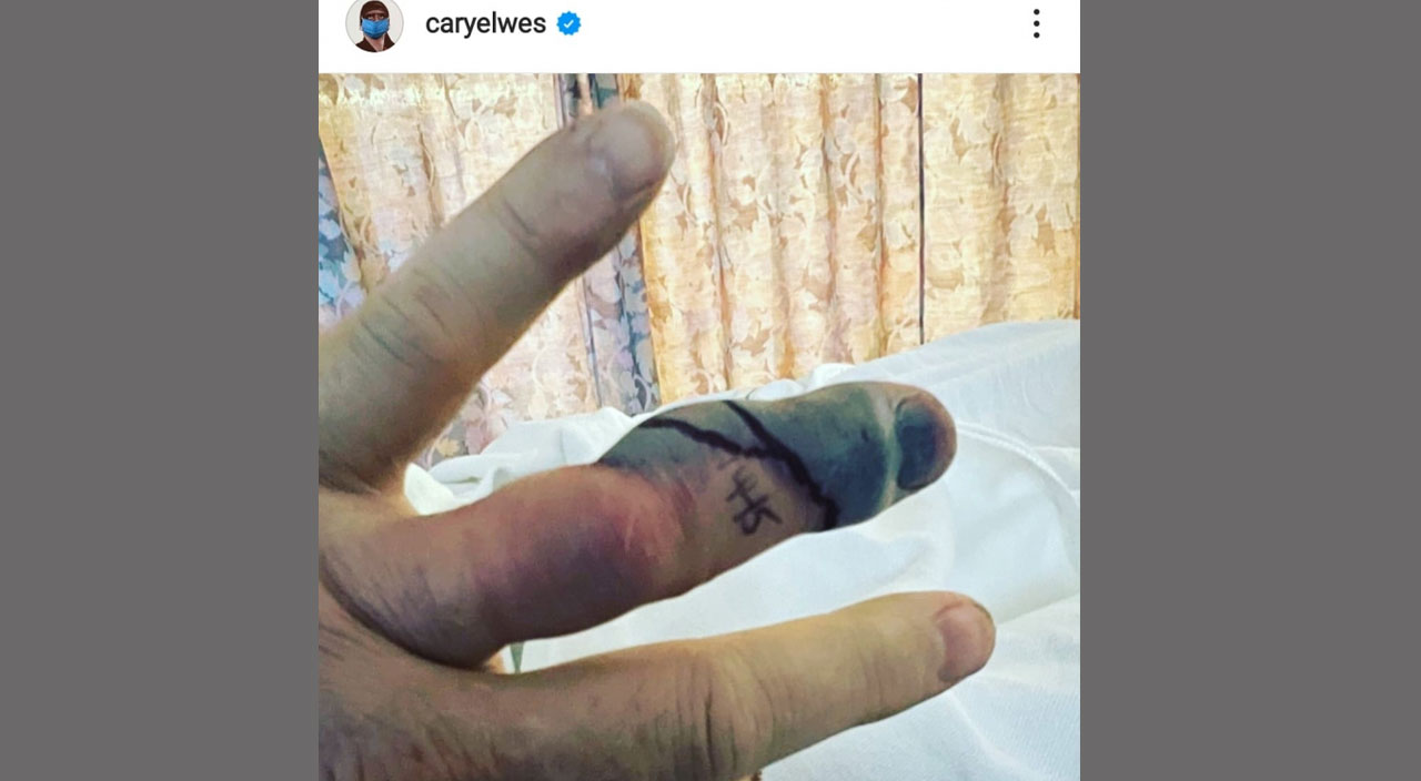‘Testere’ filmininin oyuncusu Cary Elwes’i evinde çıngıraklı yılan ısırdı ‘Testere’ filmininin oyuncusu Cary Elwes’i evinde çıngıraklı yılan ısırdı