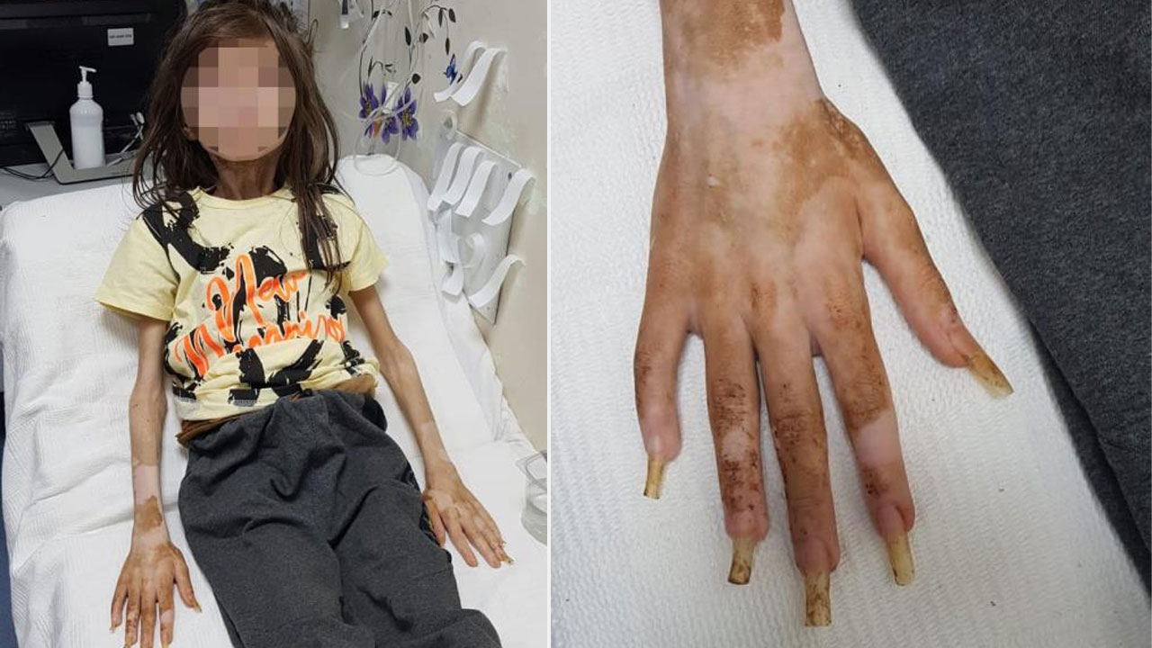 Yaşadığı kabus herkesi dehşete düşürmüştü: Cem Muhammet'ten ilk kareler