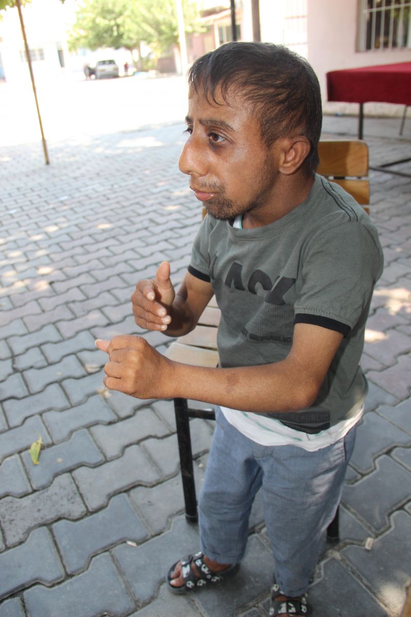 22 yılda sadece 11 kilo 400 grama ulaşabildi