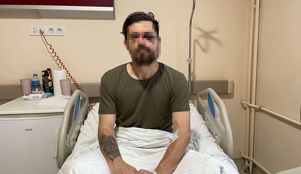 Yeşil sahada korkunç hareket: Kırmızı kart gördü, rakibinin yüzüne tekme attı Yeşil sahada korkunç hareket: Kırmızı kart gördü, rakibinin yüzüne tekme attı