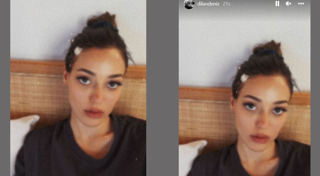 Dilan Çiçek Deniz’den kötü haber: Sette kaza geçirdi, kafasına dikiş atıldı