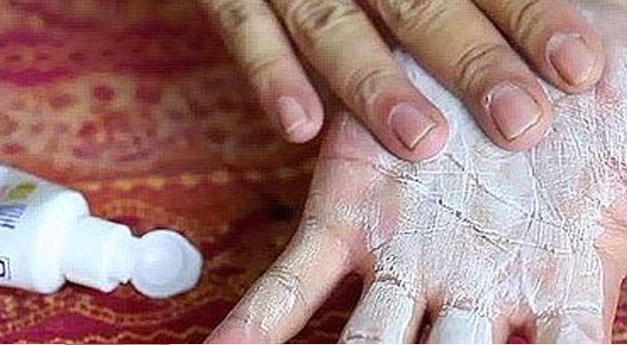 Yanığa ne iyi gelir? Diş macunu yanığa iyi gelir mi? Yoğurt yanığa iyi gelir mi?