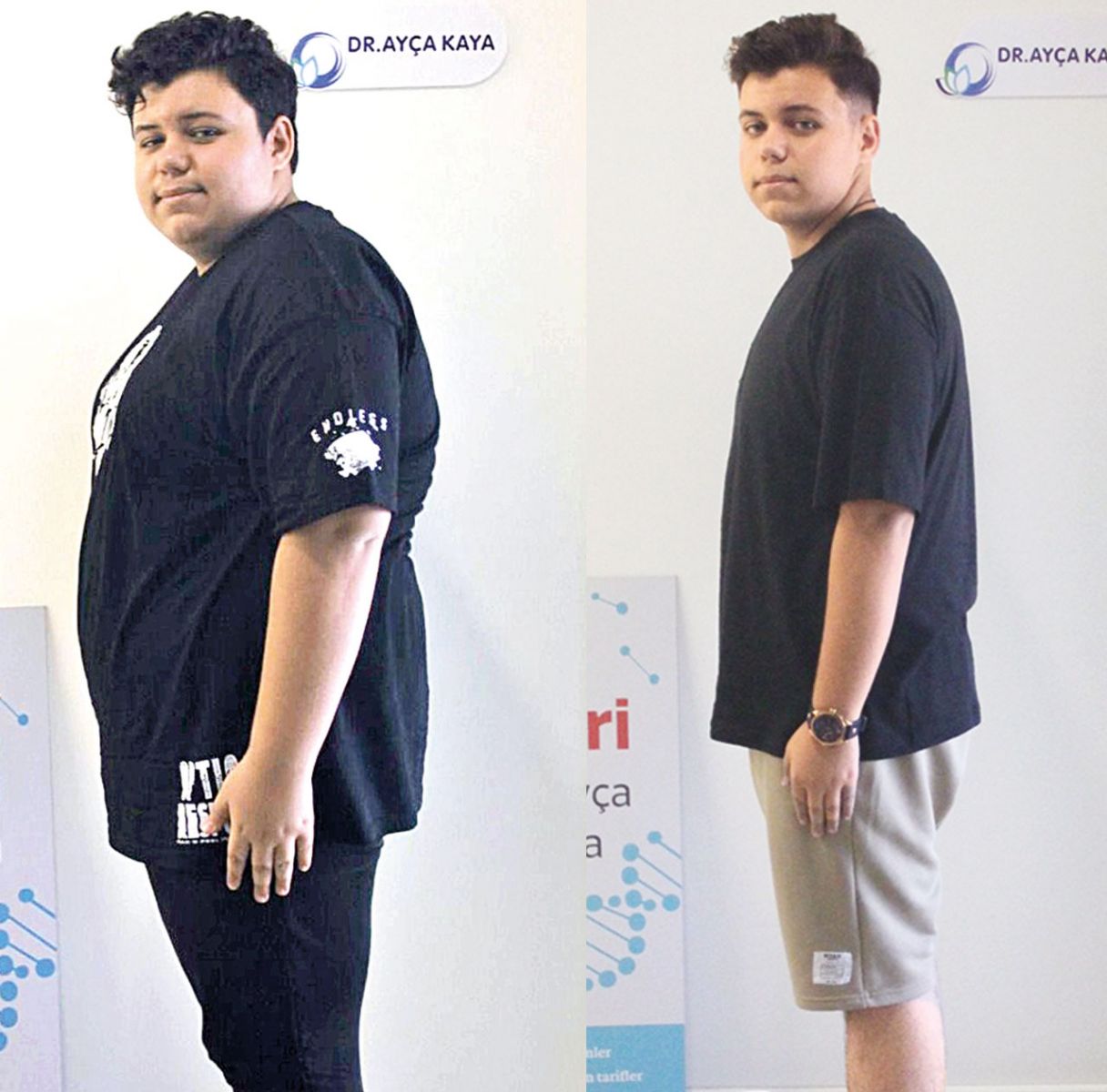 17 yaşındaki gençten büyük başarı! 1 yılda 50 kilo verdi