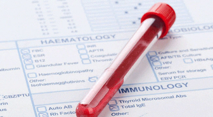 EGFR nedir? | EGFR Değeri Kaç Olmalıdır? | EGFR'de normal değerler nasıl olmalı