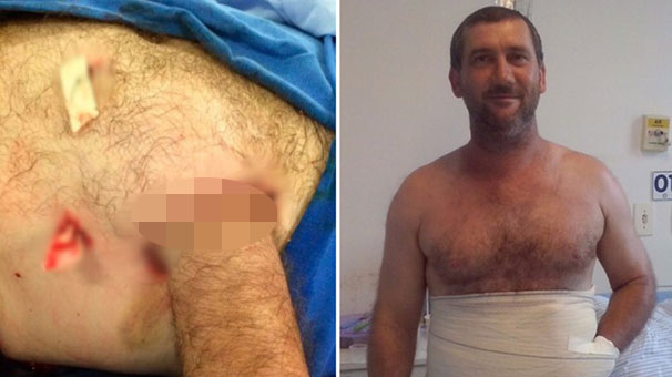 Eli karnına dikildi!