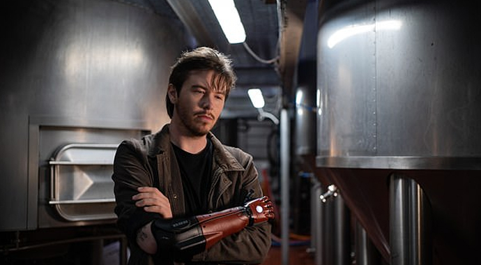 Doğuştan bir eli olmayan adam kendine bilgisayar oyunundaki gibi biyonik kol yaptırdı