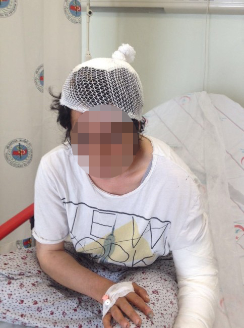 Erzincan'da koca dehşeti! Saçını yoldu, dişlerini çekti, bacağını kırdı