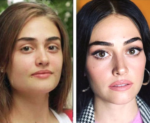 Esra Bilgiç'in eski halini gören tanıyamıyor