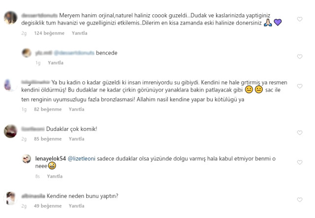 Estetiği abartan Meryem Uzerli'nin son halini gören şaşıp kalıyor