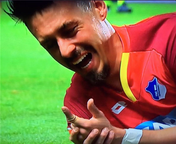 Çok feci! Parmağı ortadan ikiye kırıldı