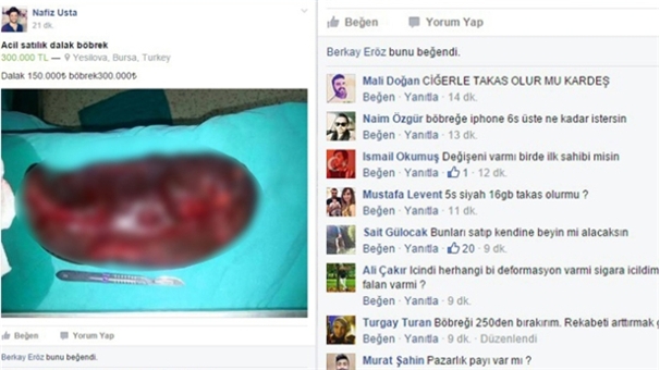 İnternette ’acil satılık dalak böbrek’ ilanı