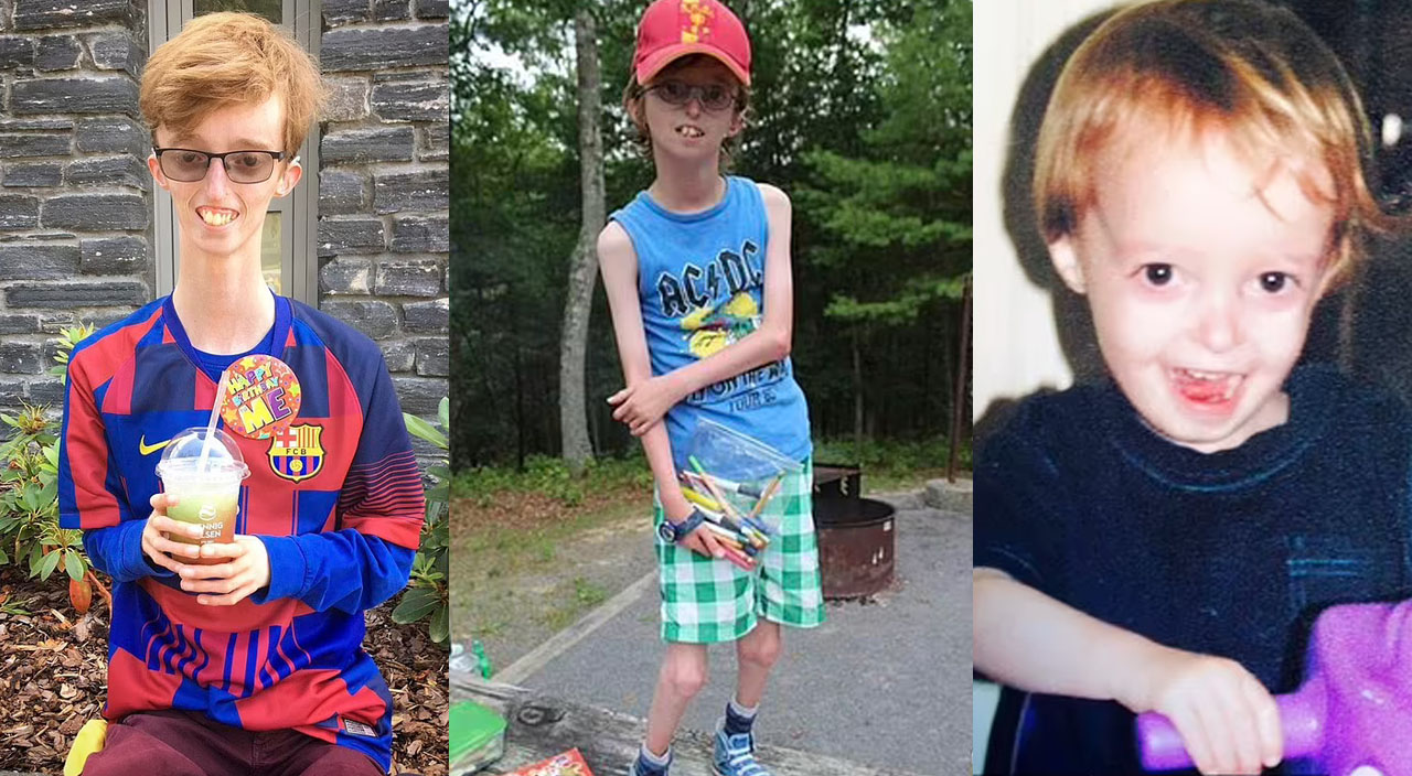 Nadir bir hastalığı var, ne yerse kilo almıyor