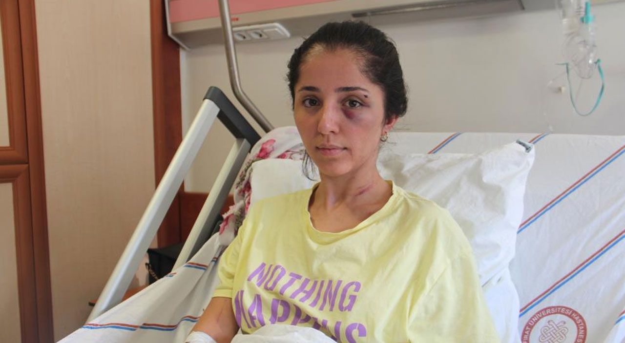 Doktor sevgilinden kan donduran işkence: Bıçak darbeleriyle ciğerini söndürdü