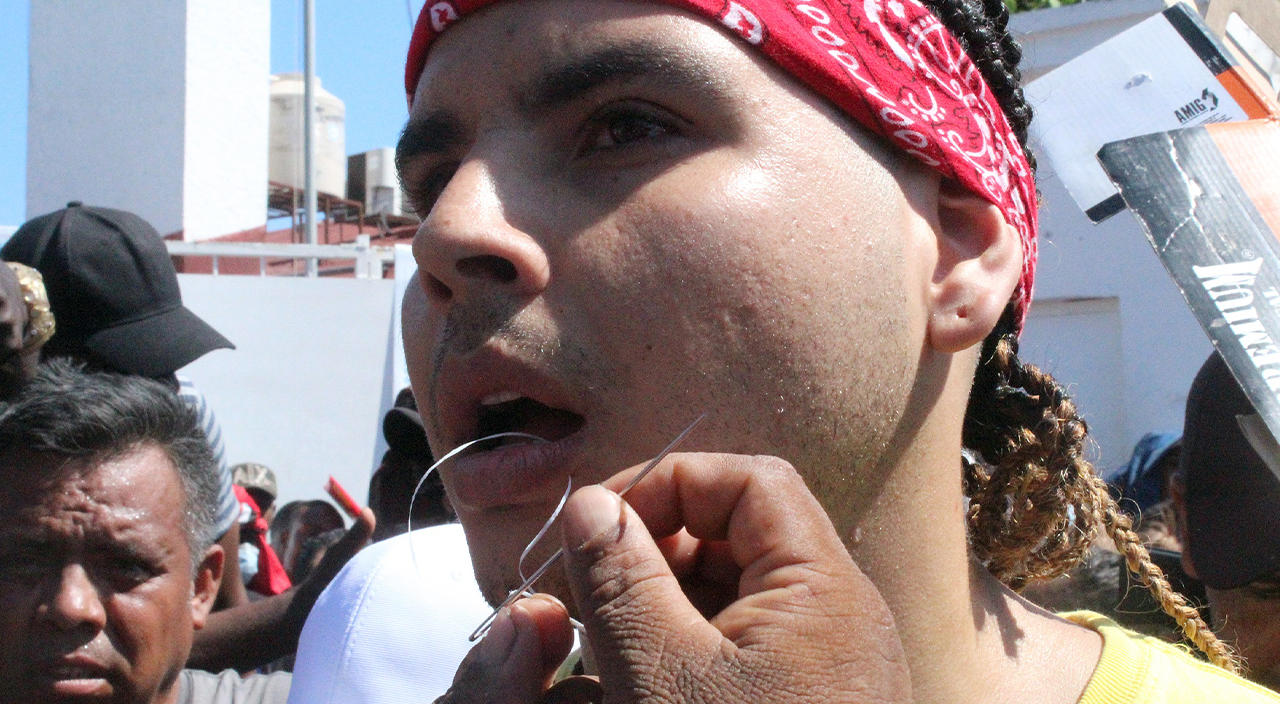 Göçmenlerden kan donduran pretosto! Ağızlarını diktiler