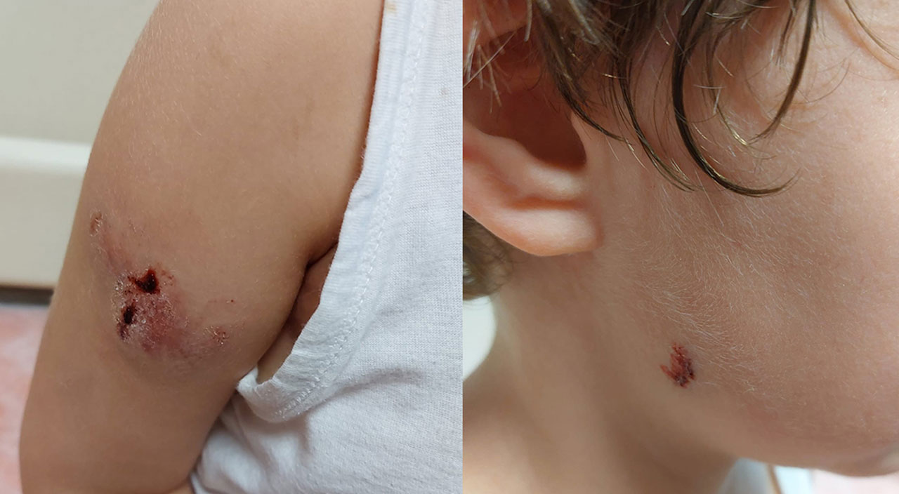 Sokak köpekleri 5 yaşındaki çocuğa dehşeti yaşattı