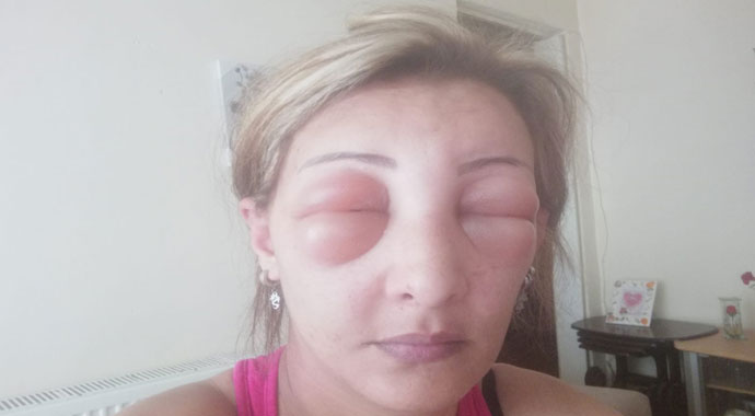 Saçlarını yaptırmak için kuaföre gitti, canından oluyordu