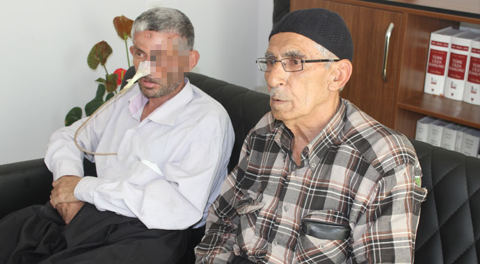 Hayret veren olay! Dişini çektirdi, gözünü kaybetti