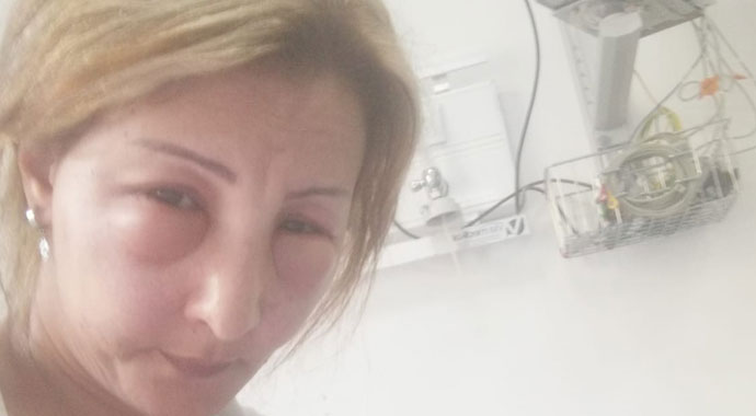Saçlarını yaptırmak için kuaföre gitti, canından oluyordu